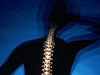 My Friend Debbie - Better Bone Health - Solutions for Osteoporosis - Part 2