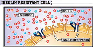 Controlling Insulin â€“ The Best Way to Guard Your Health and Lose Weight