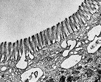 My Friend Debbie - Leaky Gut Health Problem