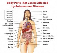 My Friend Debbie - Leaky Gut Health Problem